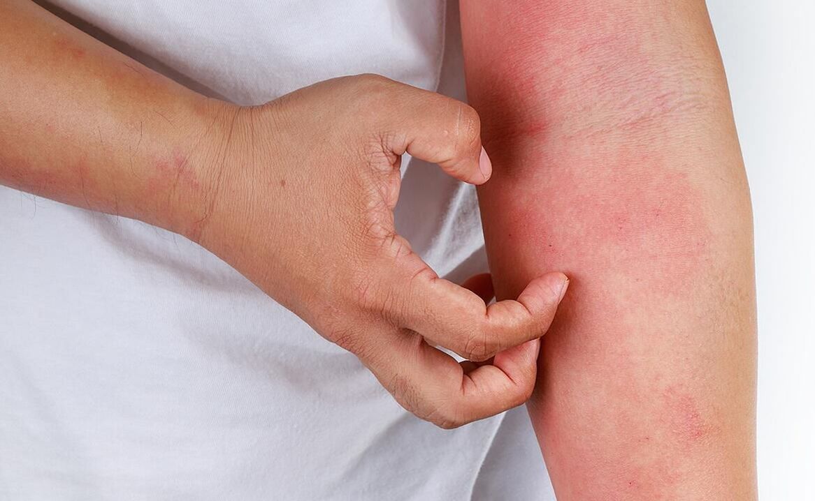posibles complicacións do uso de refrescos