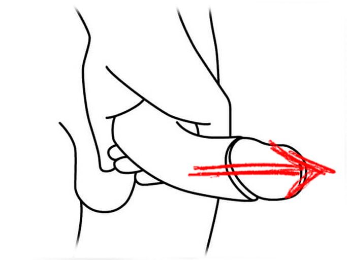 Estirando o pene por ampliación